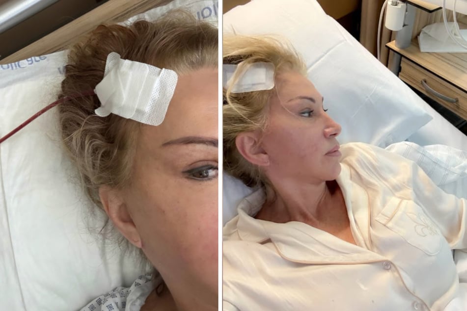Carmen Geiss (60) wurde nach einem Treppensturz am Gehirn operiert.