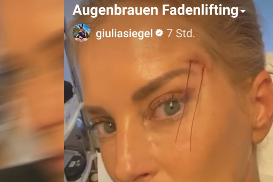 Giulia Siegel (45) hat sich die Augenbrauen "fadenliften" lassen. Wer schön bleiben will, muss eben ein bisschen leiden, oder?