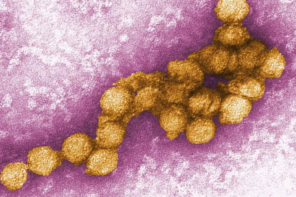 Eine elektronenmikroskopische Aufnahme des West-Nil-Virus.