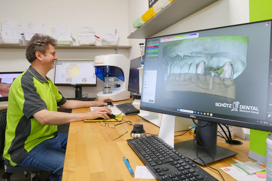 Mit der einfachen Bewerbung im Dentallabor sparst Du nicht nur Zeit, sondern auch unnötigen Papierkram.