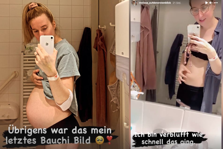 Hochzeit Auf Den Ersten Blick Melissa Staunt Uber After Baby Body 24