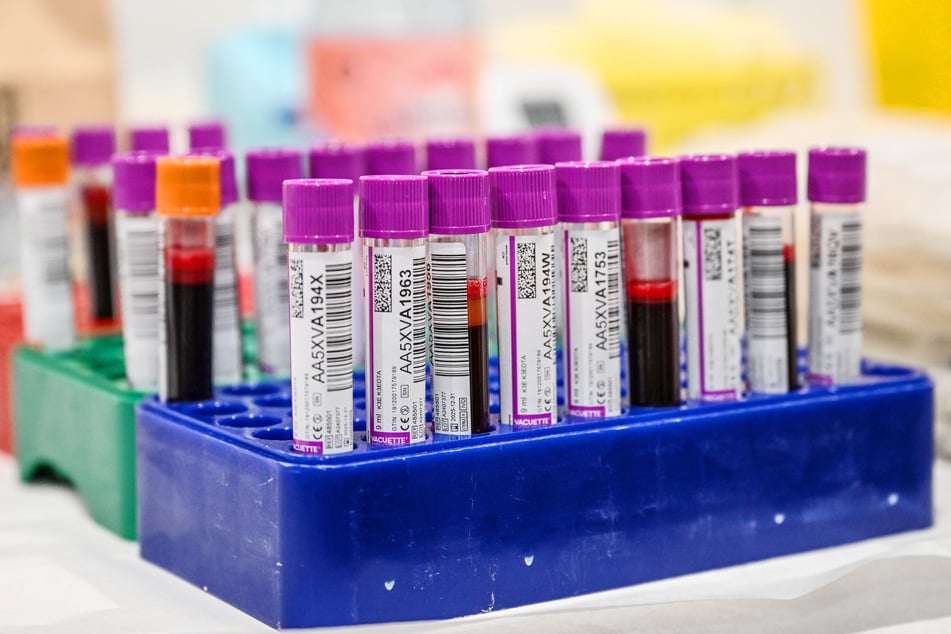 Die kurze Haltbarkeit (zwischen vier und 42 Tage) der Blutpräparate (Plasma, Blutplättchen und rote Blutkörperchen - "klassische Blutkonserve") führen dazu, dass die Krankenhäuser dauerhaft auf ein hohes Spendenaufkommen angewiesen sind.