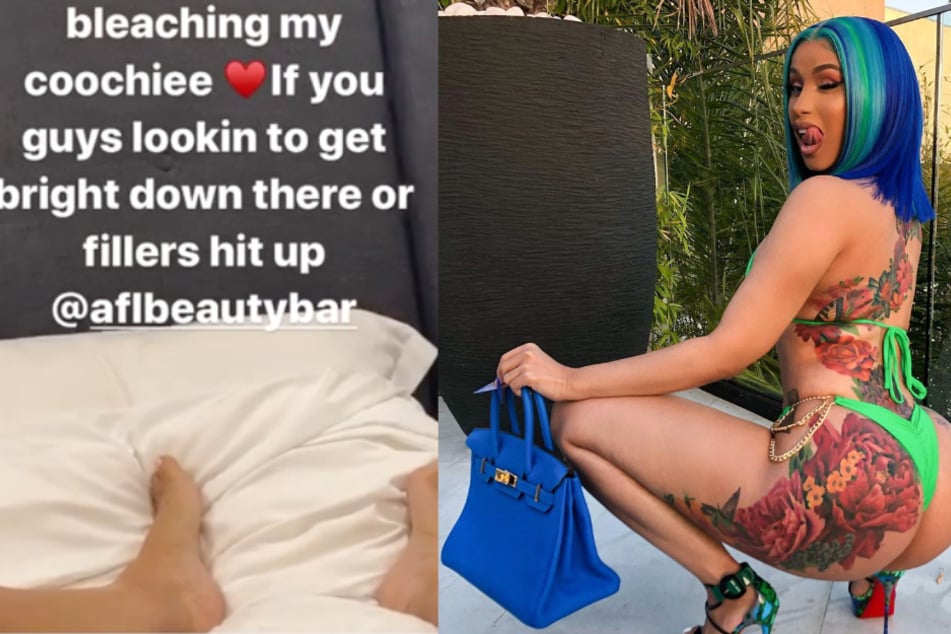 Auf Instagram gab Cardi B (279 ihren Fans Einblicke in ihr Vagina-Bleaching.
