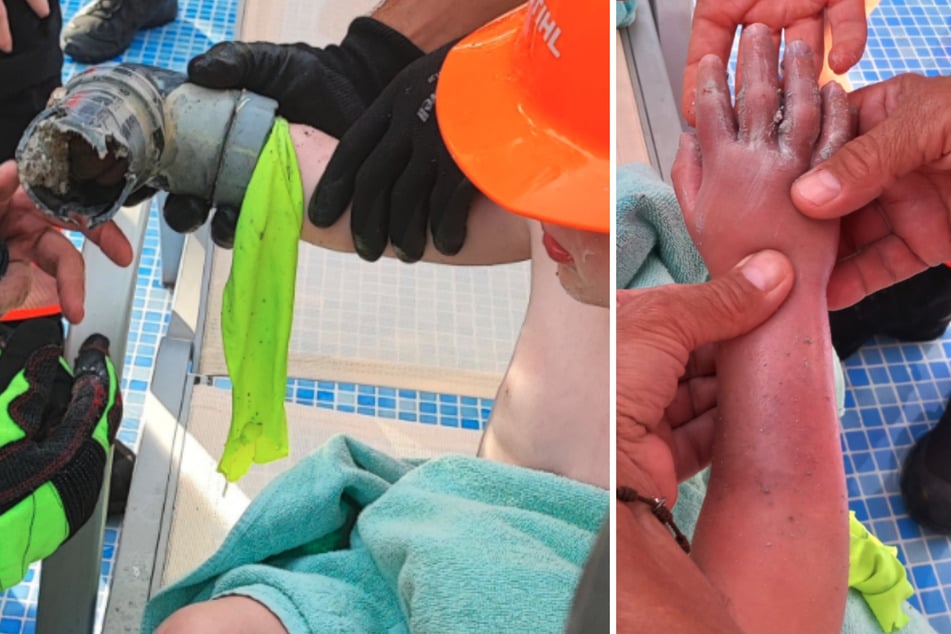 Der Arm des Fünfjährigen wurde vom starken Sog erfasst.
