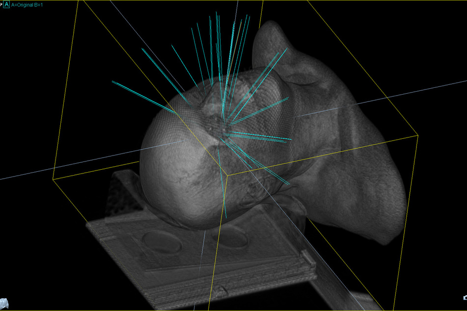 Die 3D-Ansicht zeigt: Der "Cyberknife" kann einen Tumor exakt treffen und zerstören.