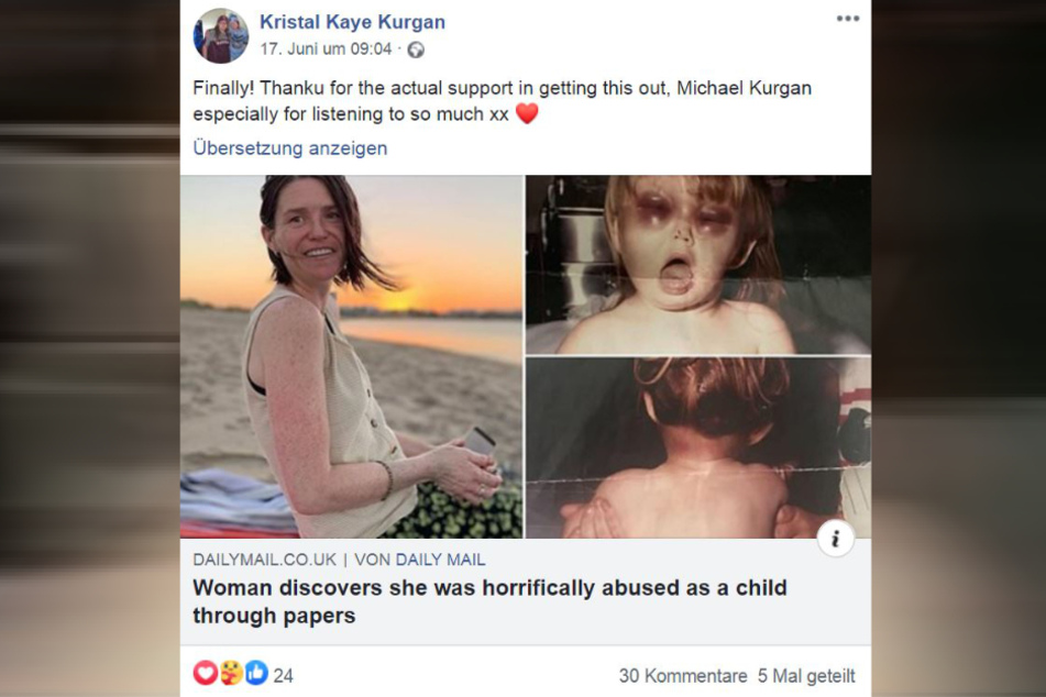 Kristal Walker bedankte sich bei der "Daily Mail" auf ihrer Facebook-Seite für die Berichterstattung, in der auch die Bilder der Misshandlungen veröffentlicht wurden.