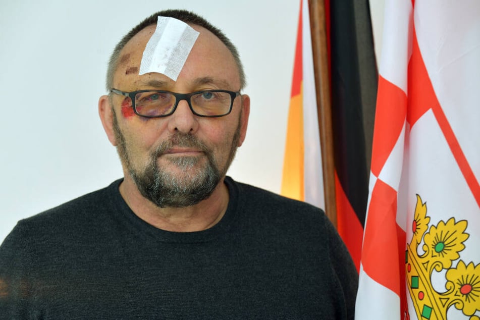 Frank Magnitz hatte wenige Tage nach dem Angriff auf ihn noch deutlich sichtbare Verletzungen im Gesicht.