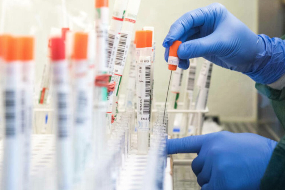 Tests auf das SARS-CoV-2-Virus werden in einem Labor ausgewertet – die fünfte Welle der Corona-Pandemie baut sich in Hessen weiter auf.