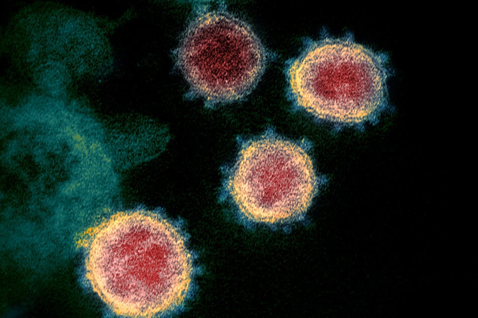 Das Coronavirus SARS-CoV-2.. Die Probe wurde von einem Patienten in den USA isoliert. (Archivbild)