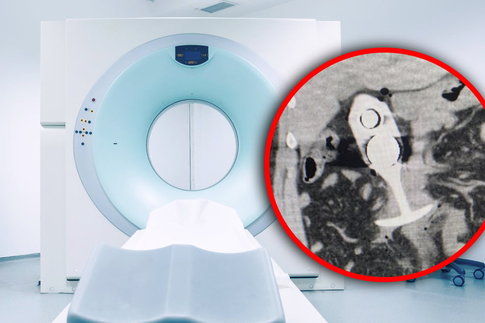 Woman starts screaming in the MRI: The reason is for adults