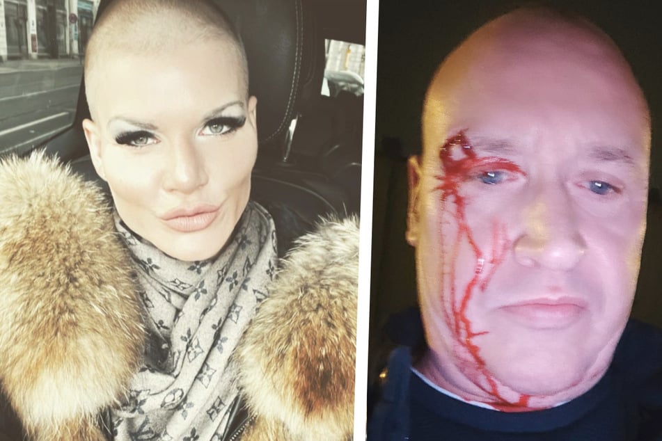 Der Rosenkrieg zwischen Melanie Müller (33) und Mike Blümer nimmt immer gefährlichere Züge an. Nun soll ein Schlägertrupp dem 56-Jährigen aufgelauert und ihn verprügelt haben!