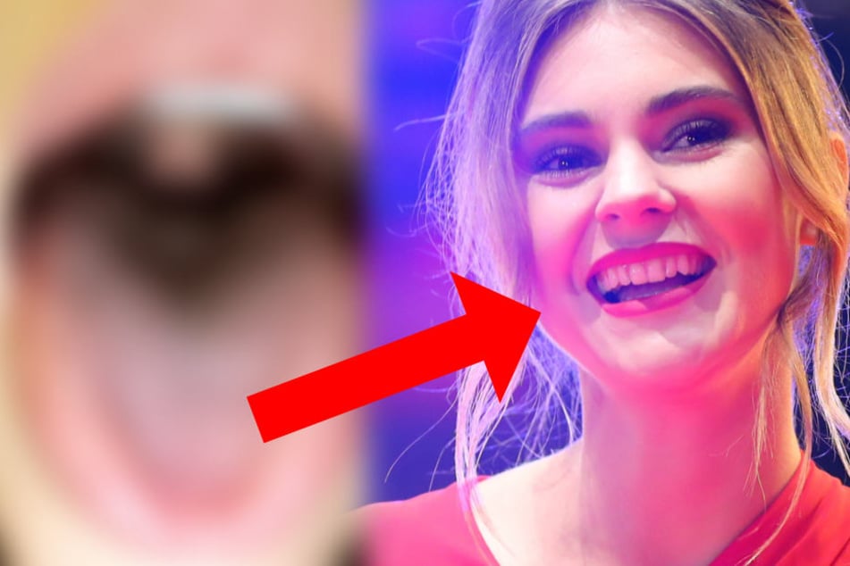"Verrückte Uvula": Stefanie Giesinger überrascht mit ungewöhnlichem Detail im Mund