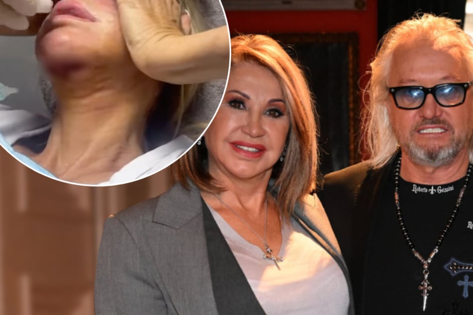 Brutaler Überfall auf die Geissens: Carmen zeigt tiefe Schnittwunde am Hals