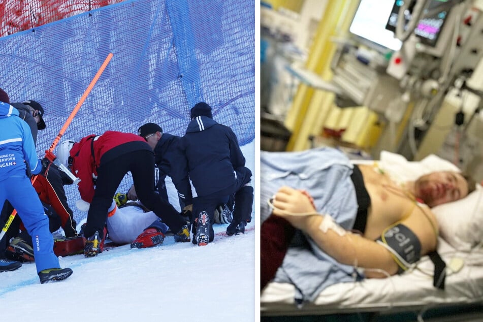 "Solche Schmerzen noch nie erlebt": Ski-Star Kilde meldet sich nach Horrorsturz zu Wort!