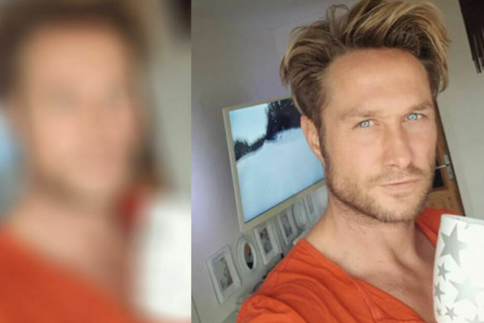 Er hat's getan! Deswegen hat sich Nico Schwanz zum Beauty-Doc begeben