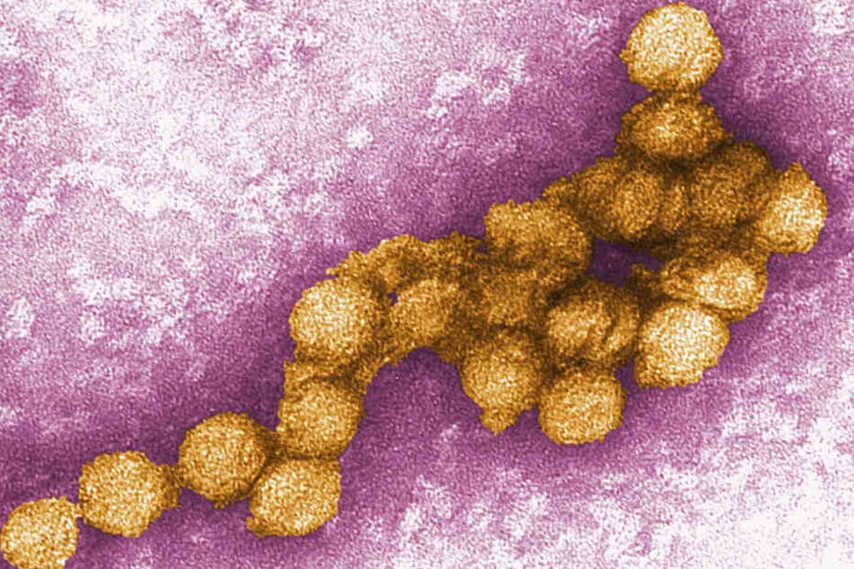 Das West-Nil-Virus unter dem Elektronenmikroskop.