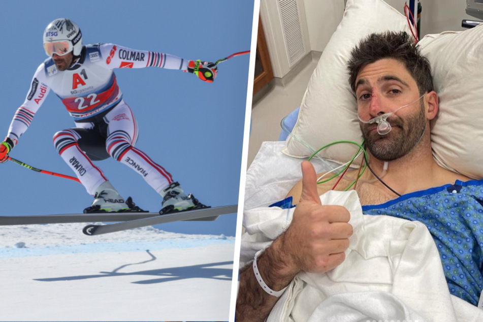 Schreckliche Verletzung im Training: Ski-Star von Ast durchbohrt!