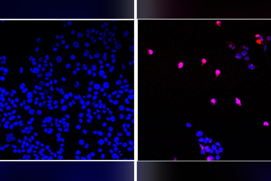 AOH1996 im Labortest: Links sind unbehandelte Krebszellen. Rechts sieht man violett gefärbte Zellen, die dank des Medikamentes absterben.