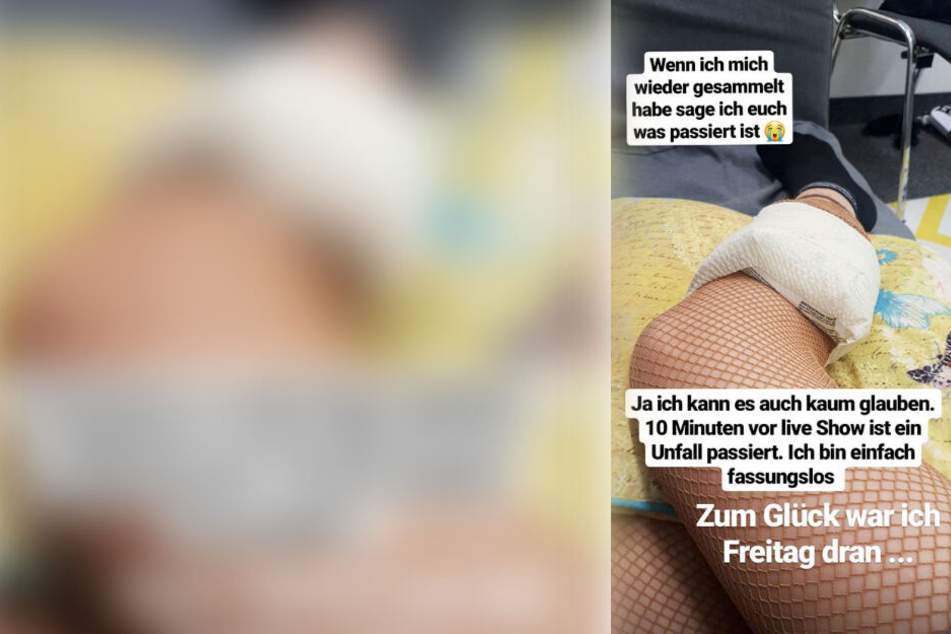 Klaudia Giez kühlt ihr geprelltes Schienbein.