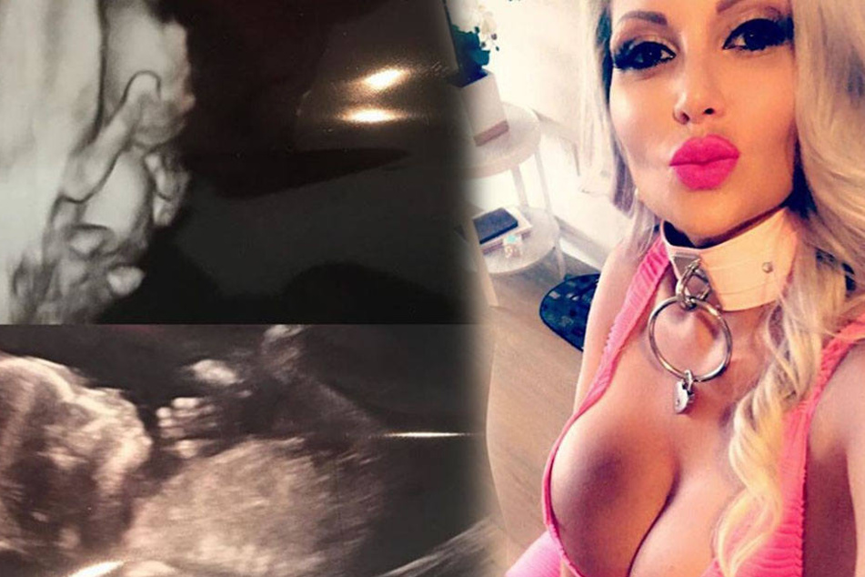 Sophia Vegas will die Zweifel der Fans aus dem Weg räumen: Vor kurzem postete sie ein Ultraschallbild.