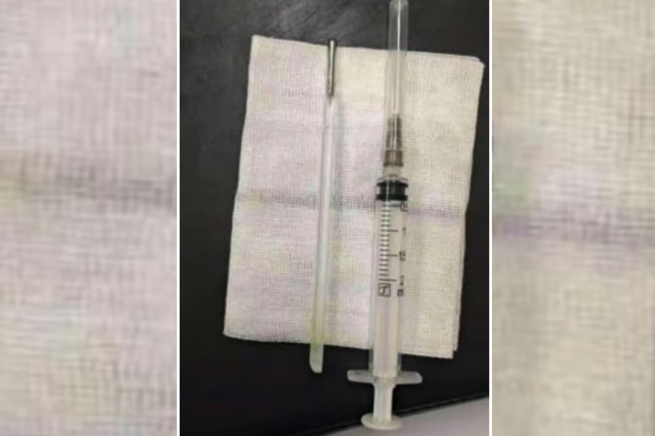 Der Fremdkörper, der zwei Jahrzehnte im Körper des Mannes war, wurde während einer Operation entfernt.