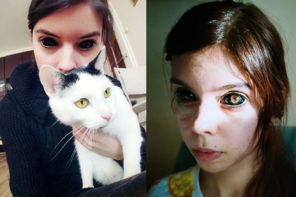 Instagram-Model erblindet, nachdem sie sich die Augen tätowieren ließ