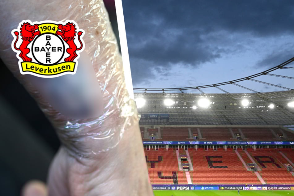 Besondere Aktion: Bayer Leverkusen spendiert Tattoos für guten Zweck