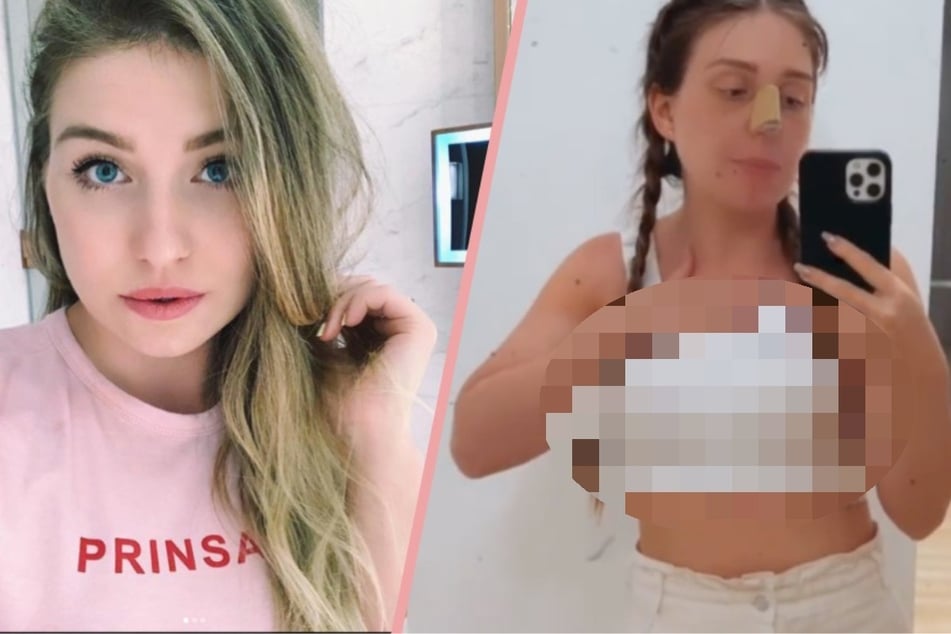 Nach Beauty-OP: Bibi Claßen zeigt auf Instagram erstmals ihre neuen Brüste
