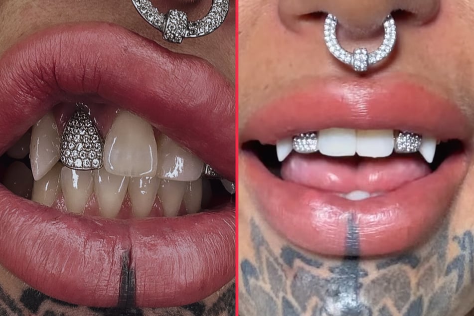 Amber Luke has two gold teeth as well as two fangs and a split tongue.