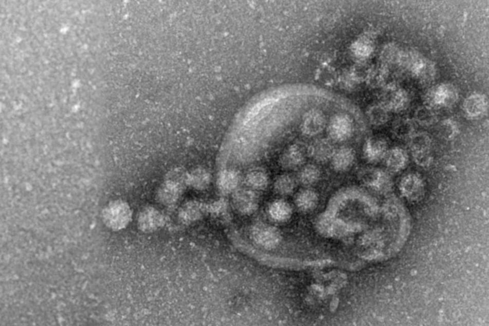 Norovirus in Hessen: Bislang wesentlich mehr Fälle des Magen-Darm-Infekts als 2023!