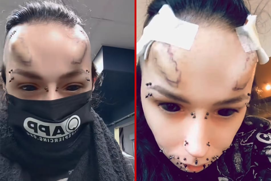 This body modification addict has inserted silicon under the skin on her forehead to make it look like she has horns.