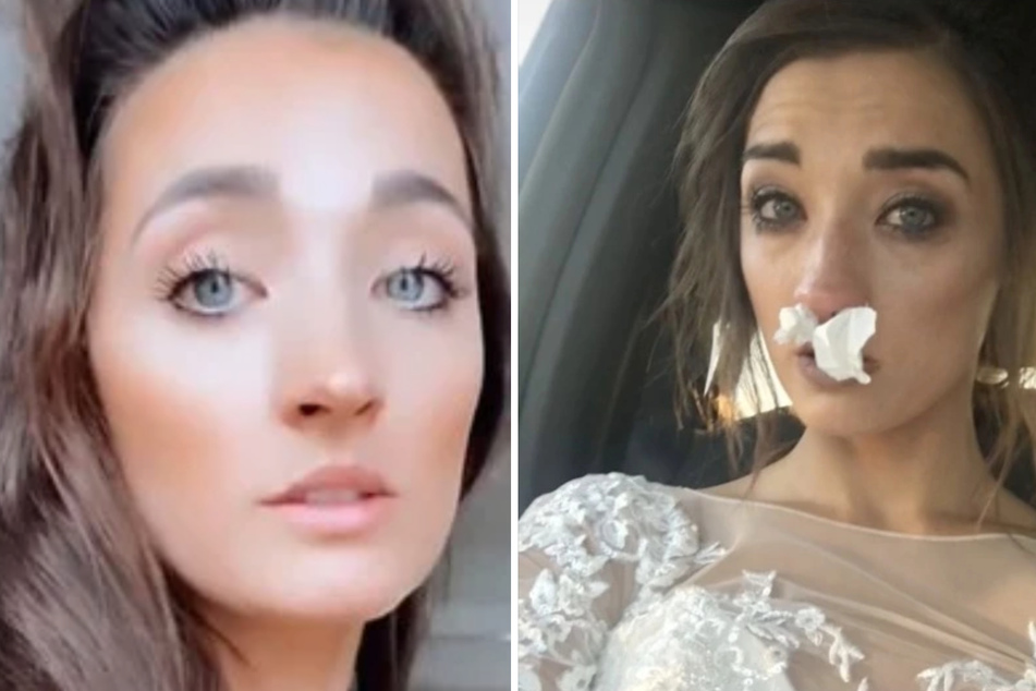 Braut hat allergische Reaktion: Was dann passiert, ruiniert ihre Hochzeit komplett