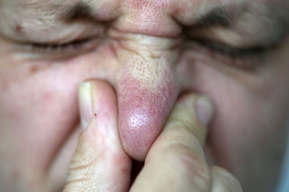 Eine Gefahr für die Gesundheit liegt durch den unangenehmen Geruch glücklicherweise nicht vor. (Symbolfoto)