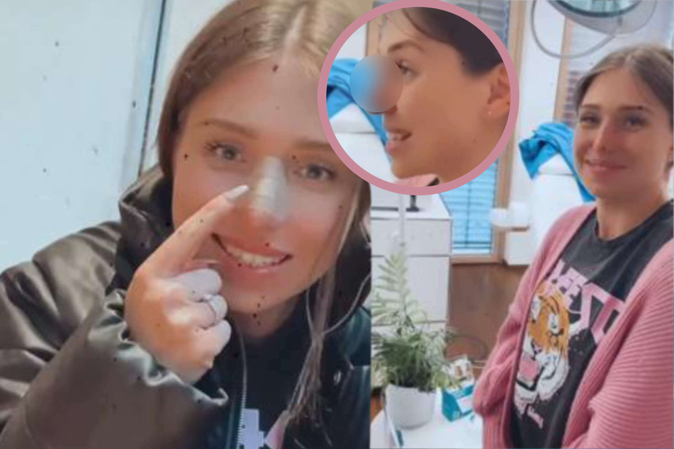 Nach Beauty-Eingriff: Bibi Claßen zeigt zum ersten Mal ihre neue Nase