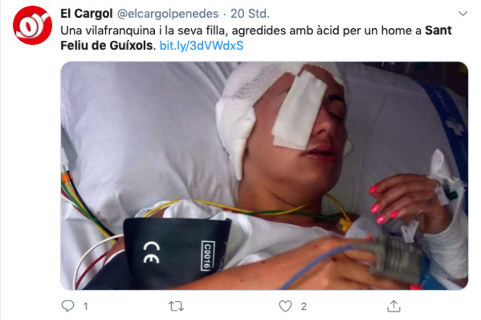 Ana Mari ist von dem Angriff ihrs Stalkers schwer gezeichnet.