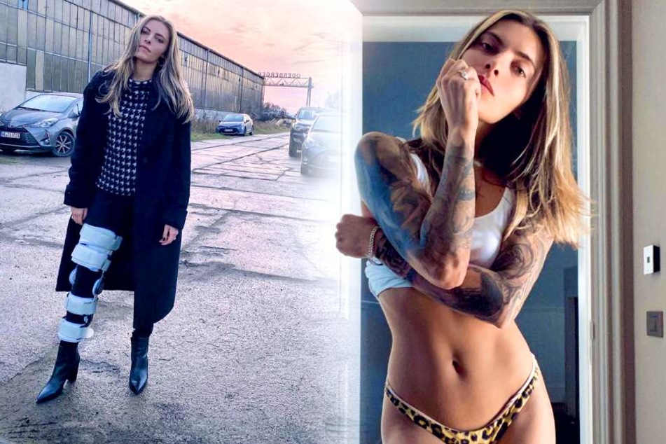 Jetzt verrät Sophia Thomalla, was wirklich hinter ihrer Beinschiene steckt!