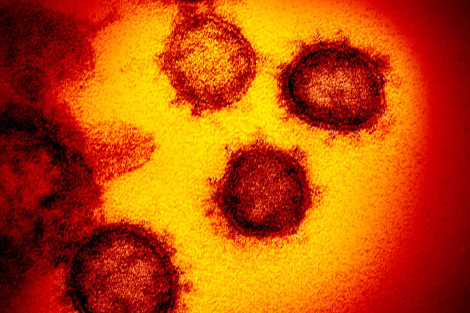 Eine undatierte elektronenmikroskopische Aufnahme des "U.S. National Institute of Health" zeigt das neuartige Coronavirus (SARS-CoV-2).