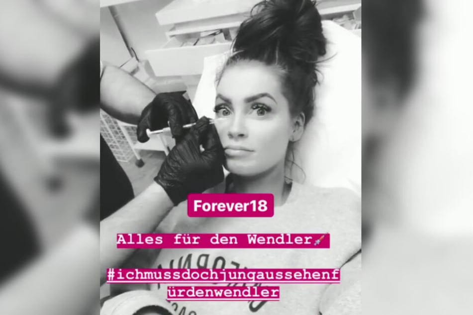 Die Reality-Darstellerin ließ sich ihre Falten wegspritzen. Für den Wendler?