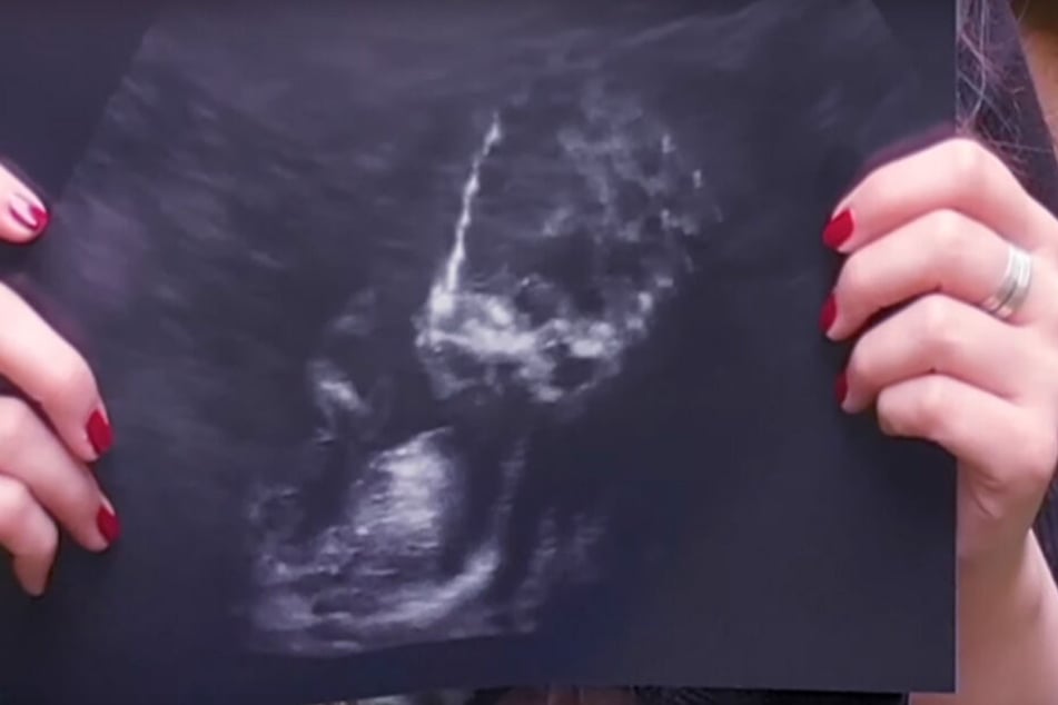 Ein Ultraschall-Bild soll ihre Alien-Schwangerschaft bezeugen.