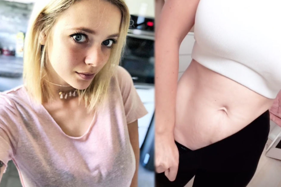 Anne Wünsche (26) zeigte bei Instagram ihre Problemzone Bauch. (Bildmontage)