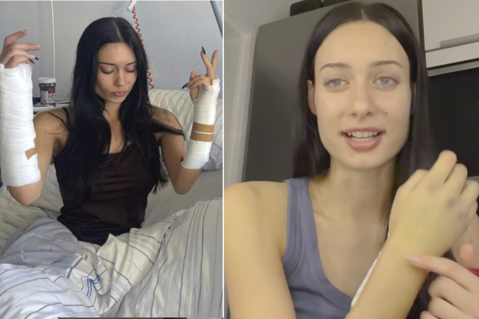 Kayla Shyx (20) meldete sich kurz nach dem Unfall bei ihren Fans und zeigte, wie es mittlerweile unter ihren Bandagen aussieht.