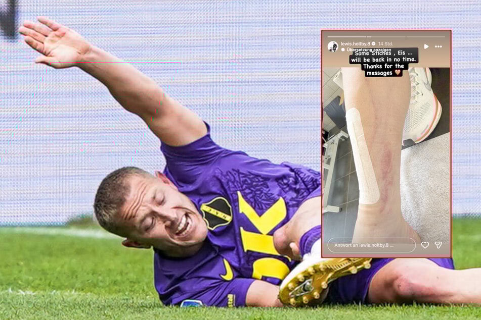 Ex-HSV-Profi Lewis Holtby (35) zog sich am Wochenende eine tiefe Wunde zu.