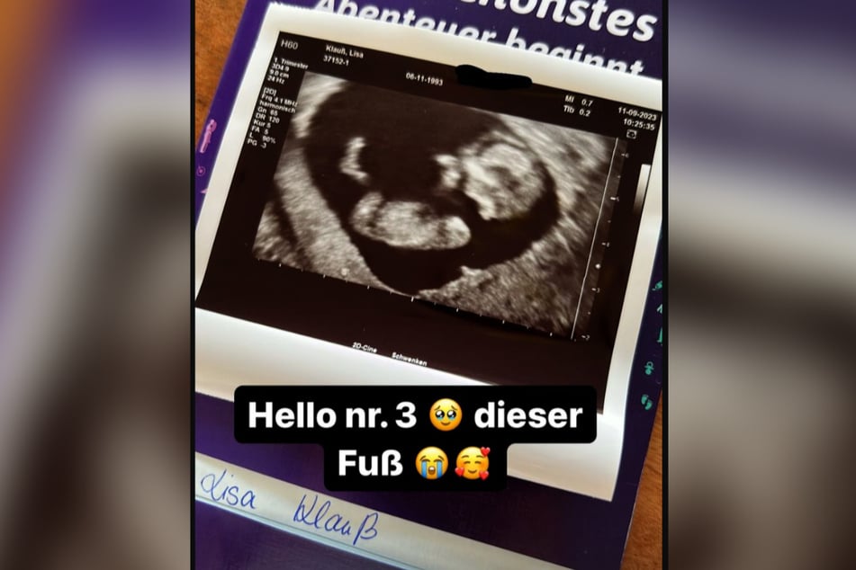 Lisa Klauß (29) wird zum dritten Mal Mutter.