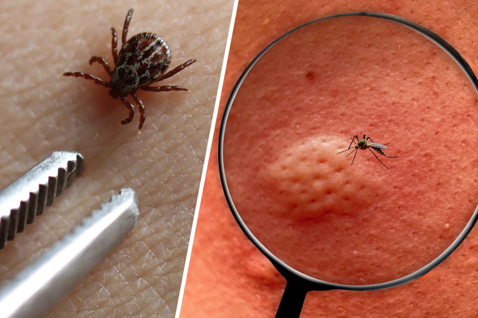 Milben, Mücken, Zecken und Co.: Das könnt Ihr gegen die Blutsauger tun