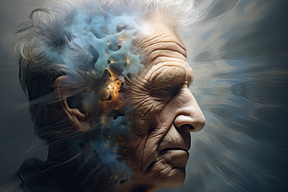 Alzheimer ist die häufigste Demenzform.