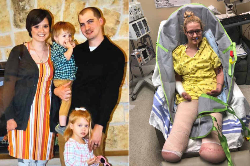 Blutvergiftung nach OP! Frau fällt ins Koma und verliert beide Beine: Doch das ist noch nicht alles