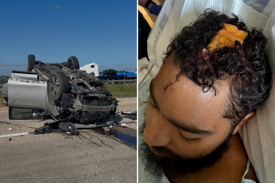 Bei einem schweren Unfall im US-Bundesstaat Texas erlitt Zach Seaback (23) eine tiefe Platzwunde.