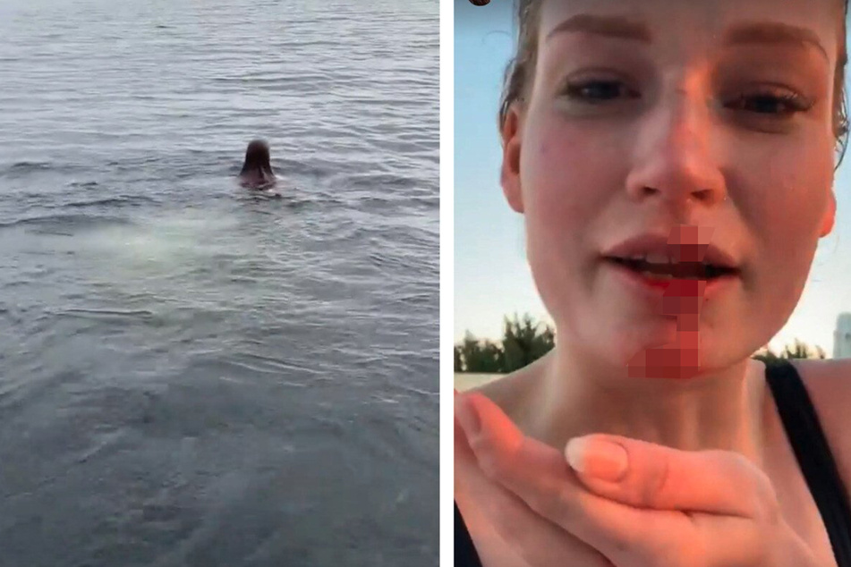 Links: Jana Heinisch (27) nach ihrem erfolgreichen Kopfsprung. Rechts: Jana nach ihrem Unfall vor rund zwei Jahren auf Rhodos.
