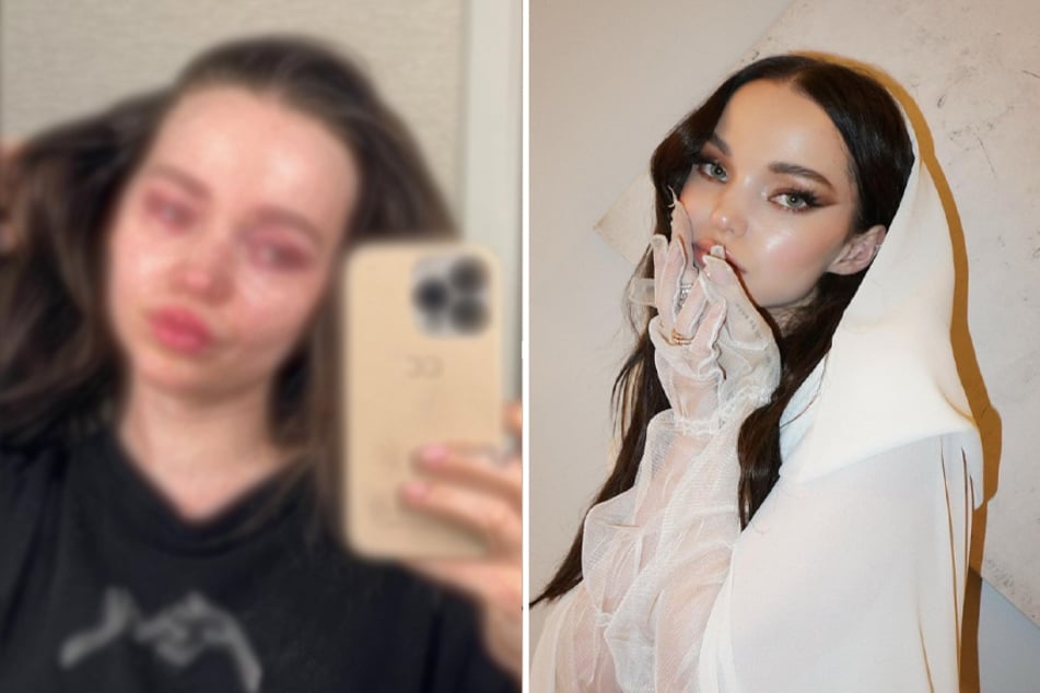Dove Cameron gets real about depression in candid snaps