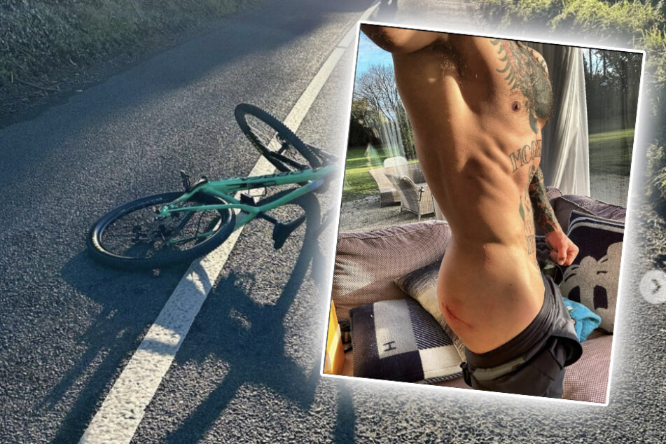 Auf Instagram zeigte Conor McGregor (34) seine Unfallverletzung. Neben einer Menge Muskeln ist auch ein großer Kratzer auf seinem rechten Po zu sehen.